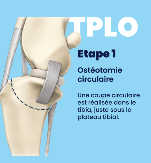 schéma tplo 01