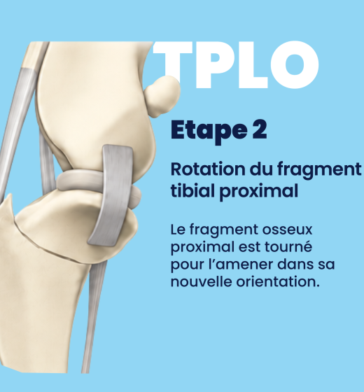 schéma tplo 02